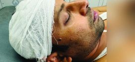 স্বেচ্ছাসেবক লীগ নেতার নেতৃত্বে সাংবাদিককে পিটিয়ে জখম, মাথায় ৬ সেলাই